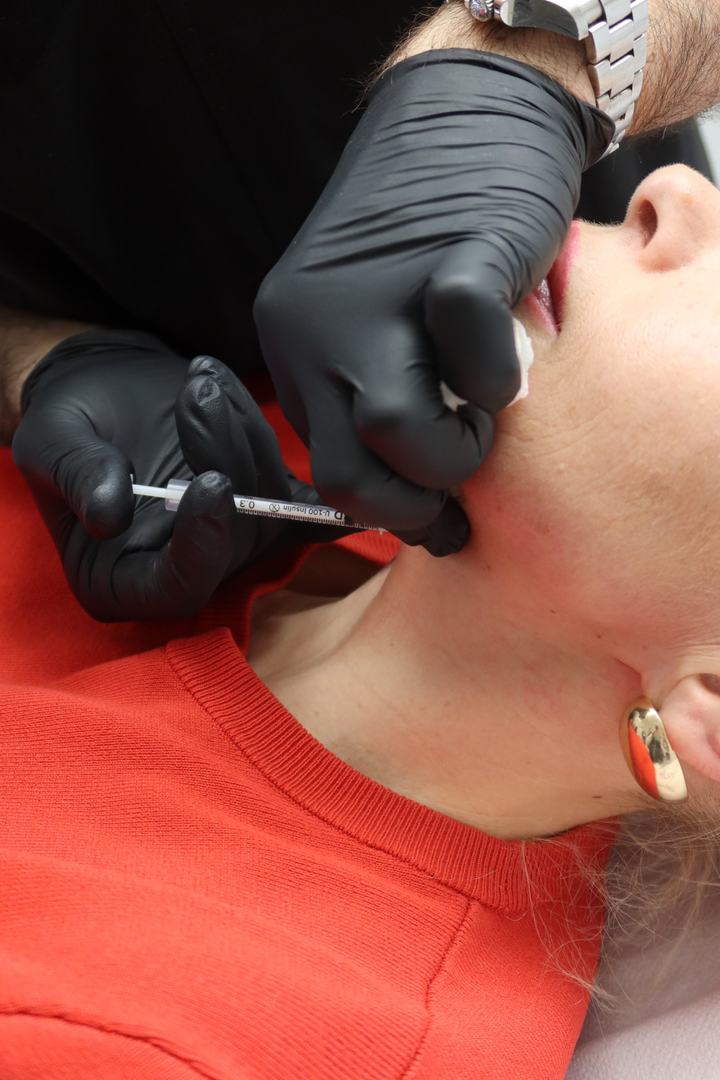 Injection de toxine botulique le long de l'ovale du visage et du cou