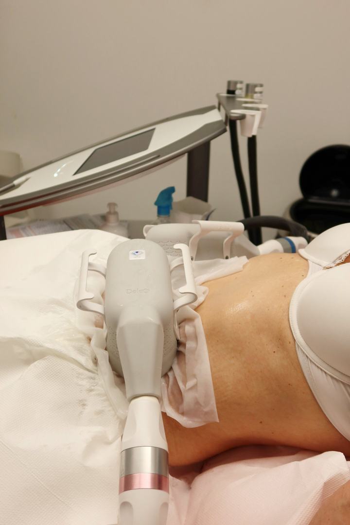 Séance de cryolipolyse sur l'abdomen avec le CRISTAL Pro (Deleo)